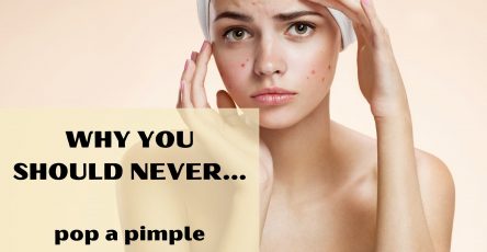 Why you should never pop a pimple